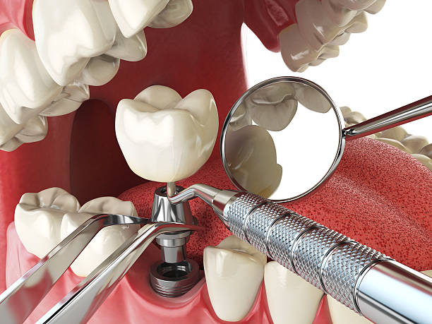 Best Walk-In Emergency Dental Services in South Kensington, MD
